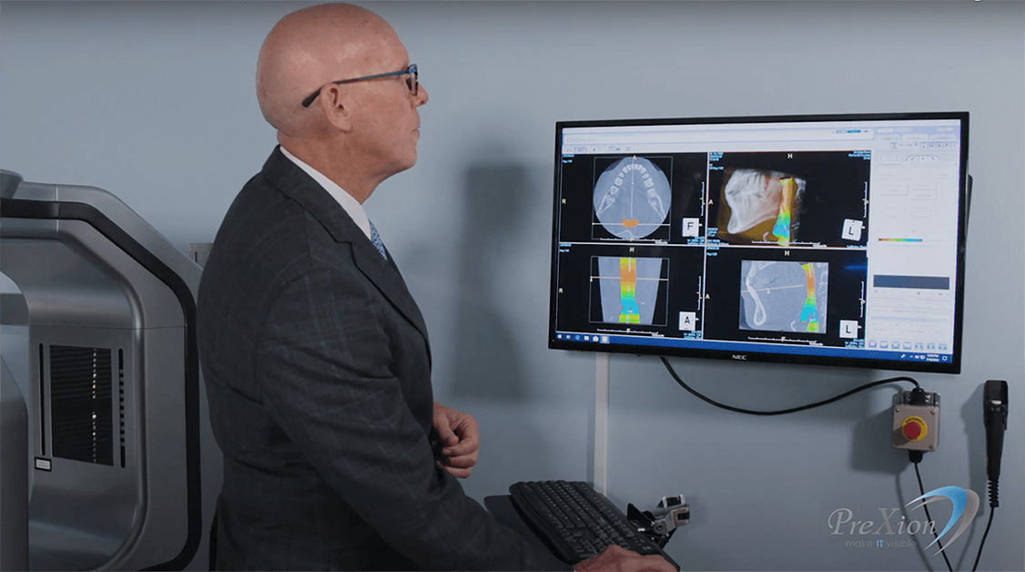 CBCT imaging