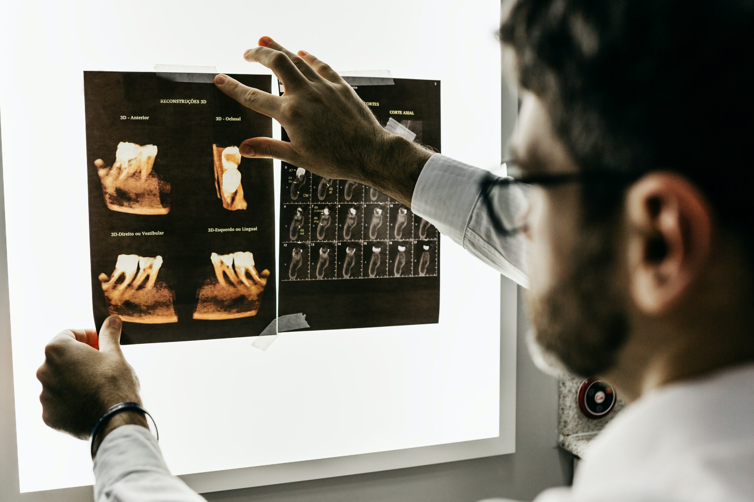 2D dental X-rays