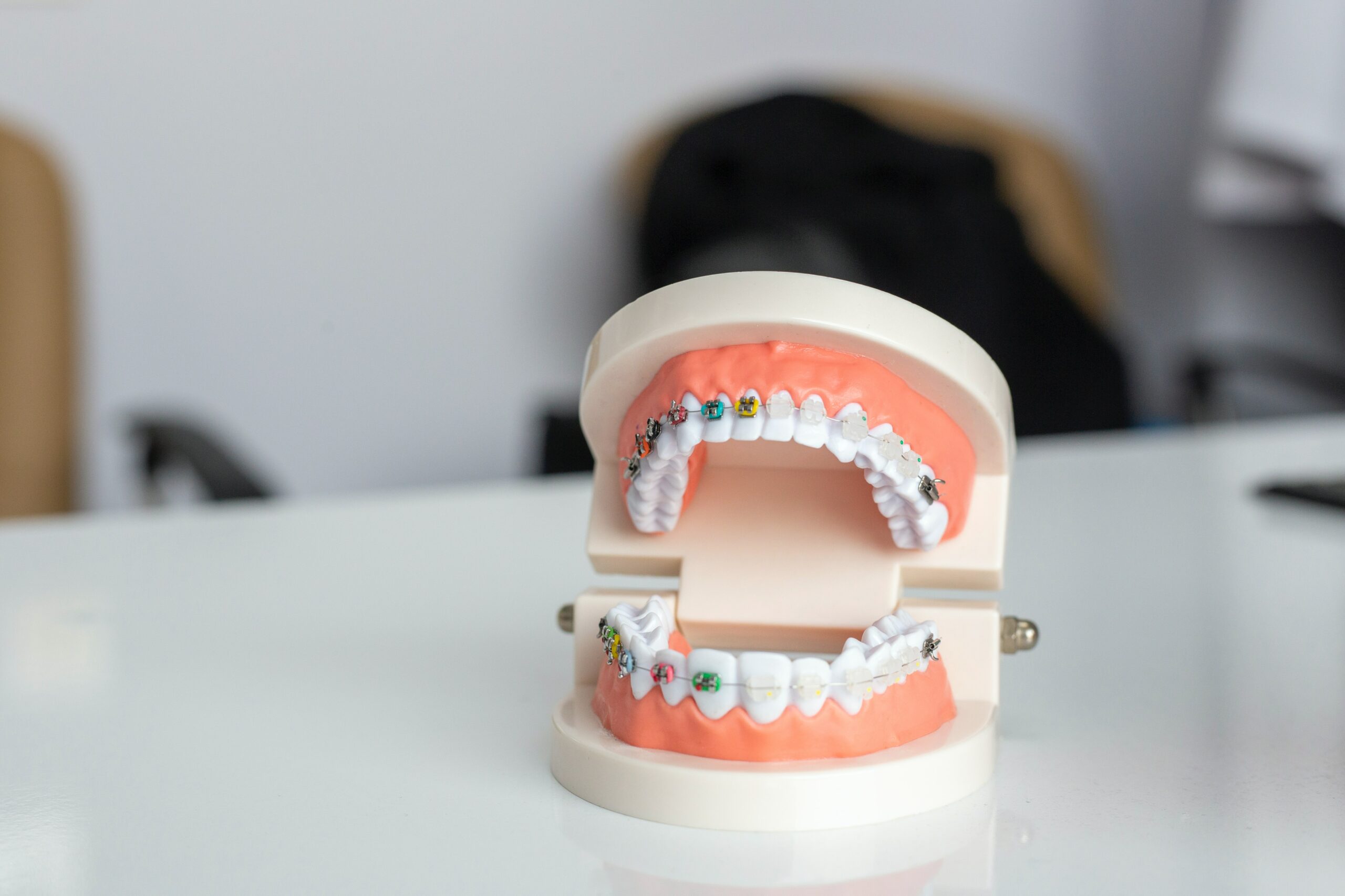 A model of teeth with metal braces