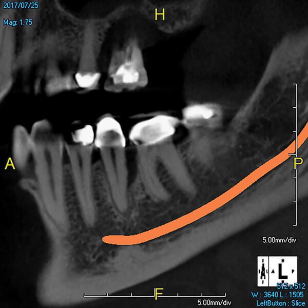 periodontics scan example