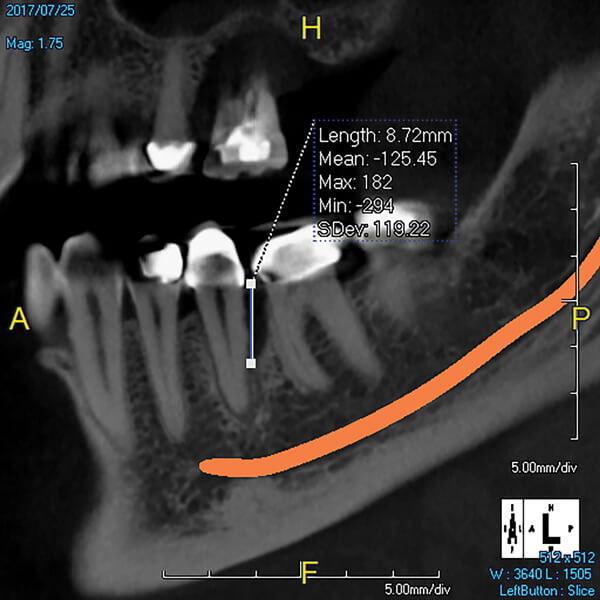 detailed cbct scan