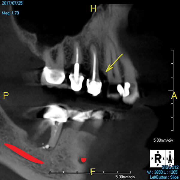 cbct periodontics scan examples
