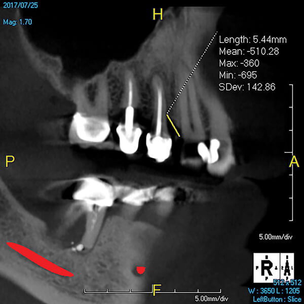 imaging in periodontics