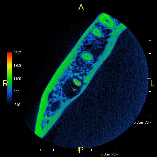 prexion image using cbct