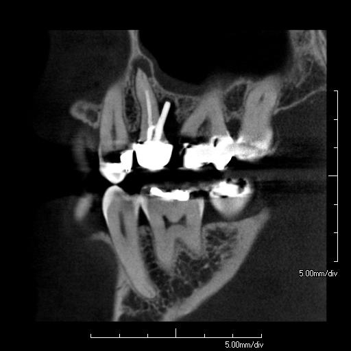 mouth scan