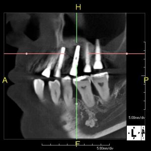 cbct imaging detail