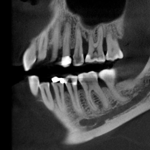 2d periodontics cbct scan