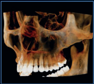 10x8cm image