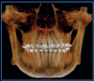 15x8cm image