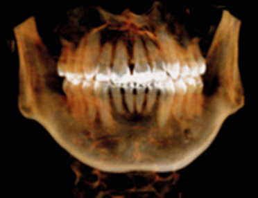 15x8cm image