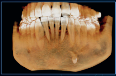 10x5cm image
