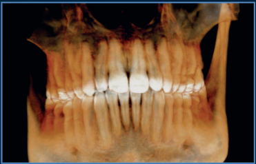 10x8cm image