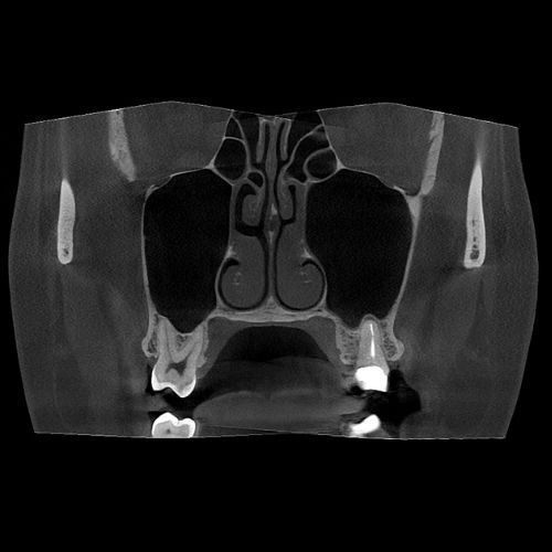 fov_14x9_1 10x8cm image