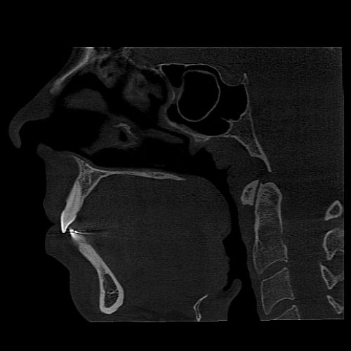 fov_16x15_1 15x8cm image