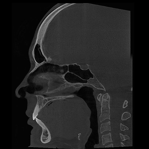 fov_16x21_1 15x8cm image