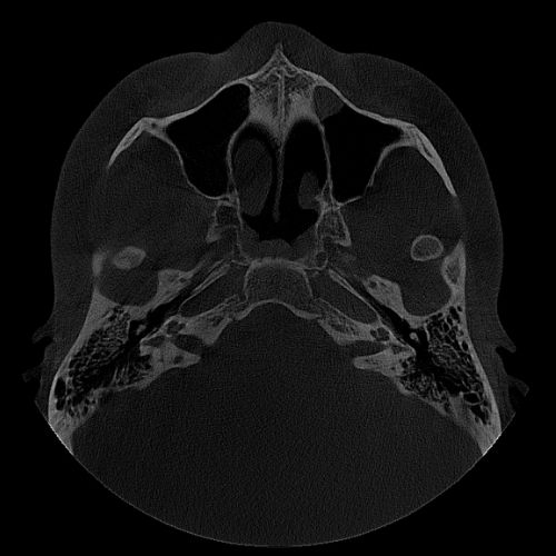 fov_16x9_1 15x8cm image