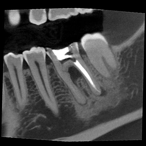 fov_5x5_1 5x5cm image