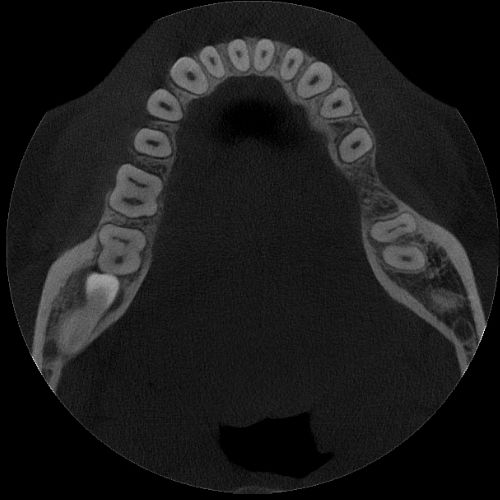 fov_9x6_1 10x5cm image