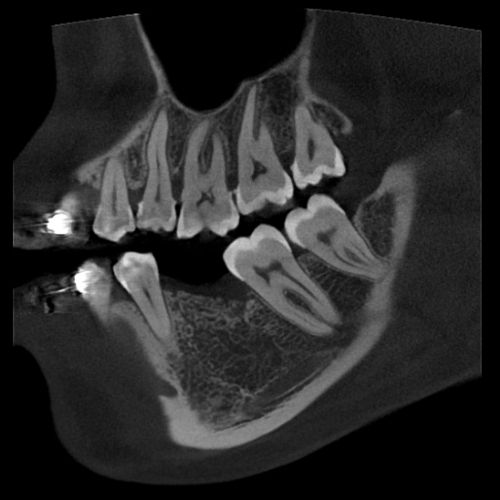 fov_9x9_1 10x8cm image